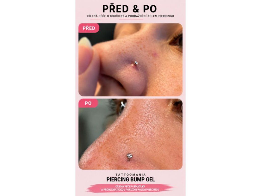 Detailné balenie Piercing BUMP GÉL